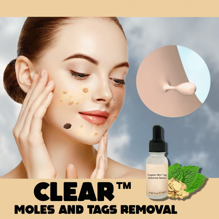 Spotless Skin Serum™- Organisches Serum zur Lösung von Hautflecken