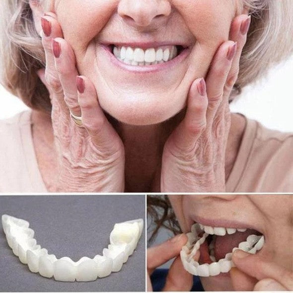 Veneers | Ultradünnes Acrylharz | Sofortiges Lächeln | Smilence