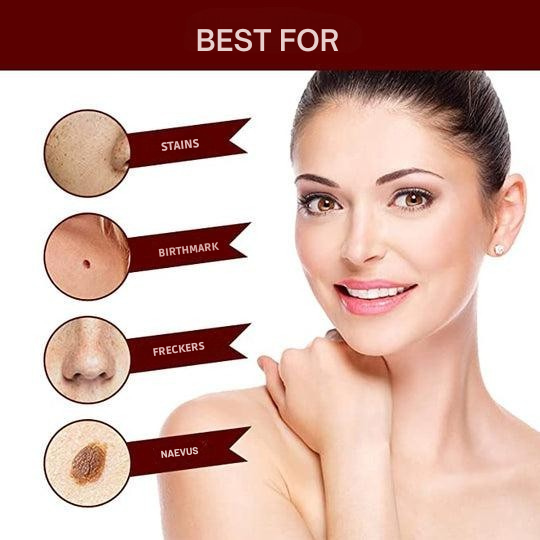 Warzenentferner | Präzisions Applikator für punktuelle Anwendung | Pflanzliche Pflegeformel | WartOff