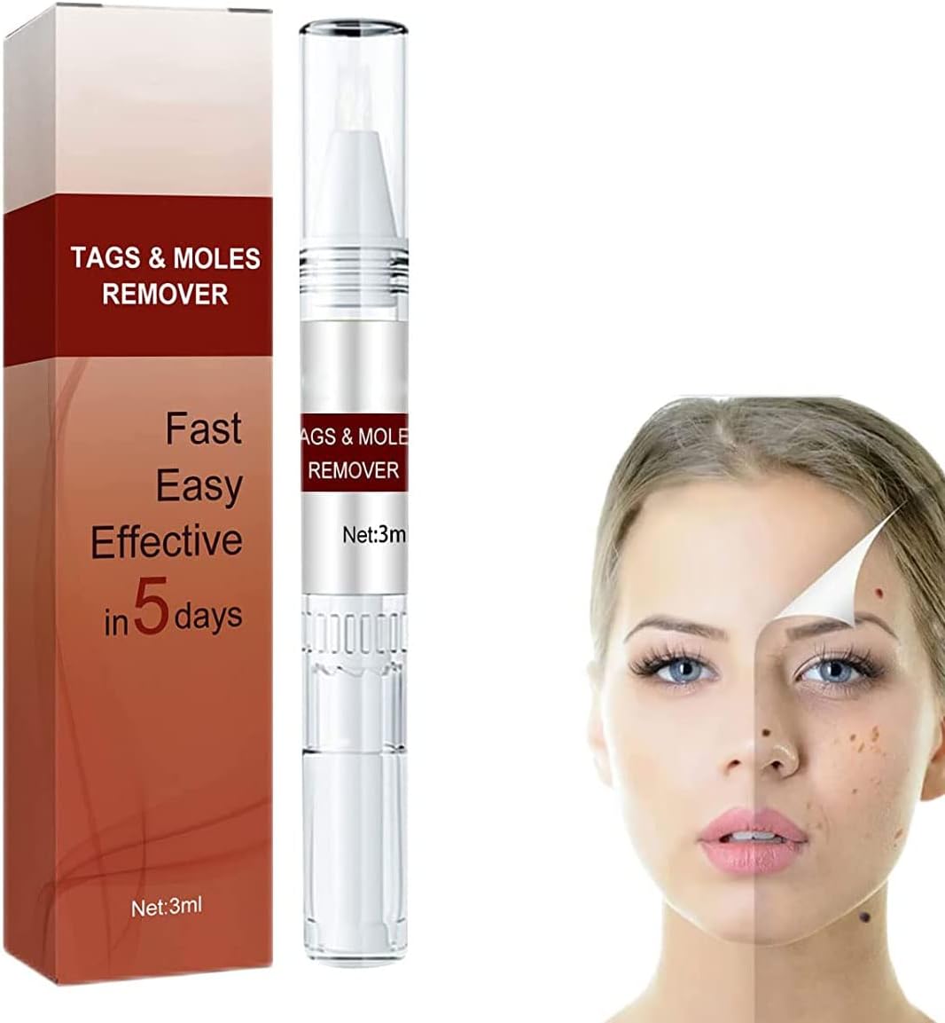 Warzenentferner | Präzisions Applikator für punktuelle Anwendung | Pflanzliche Pflegeformel | WartOff