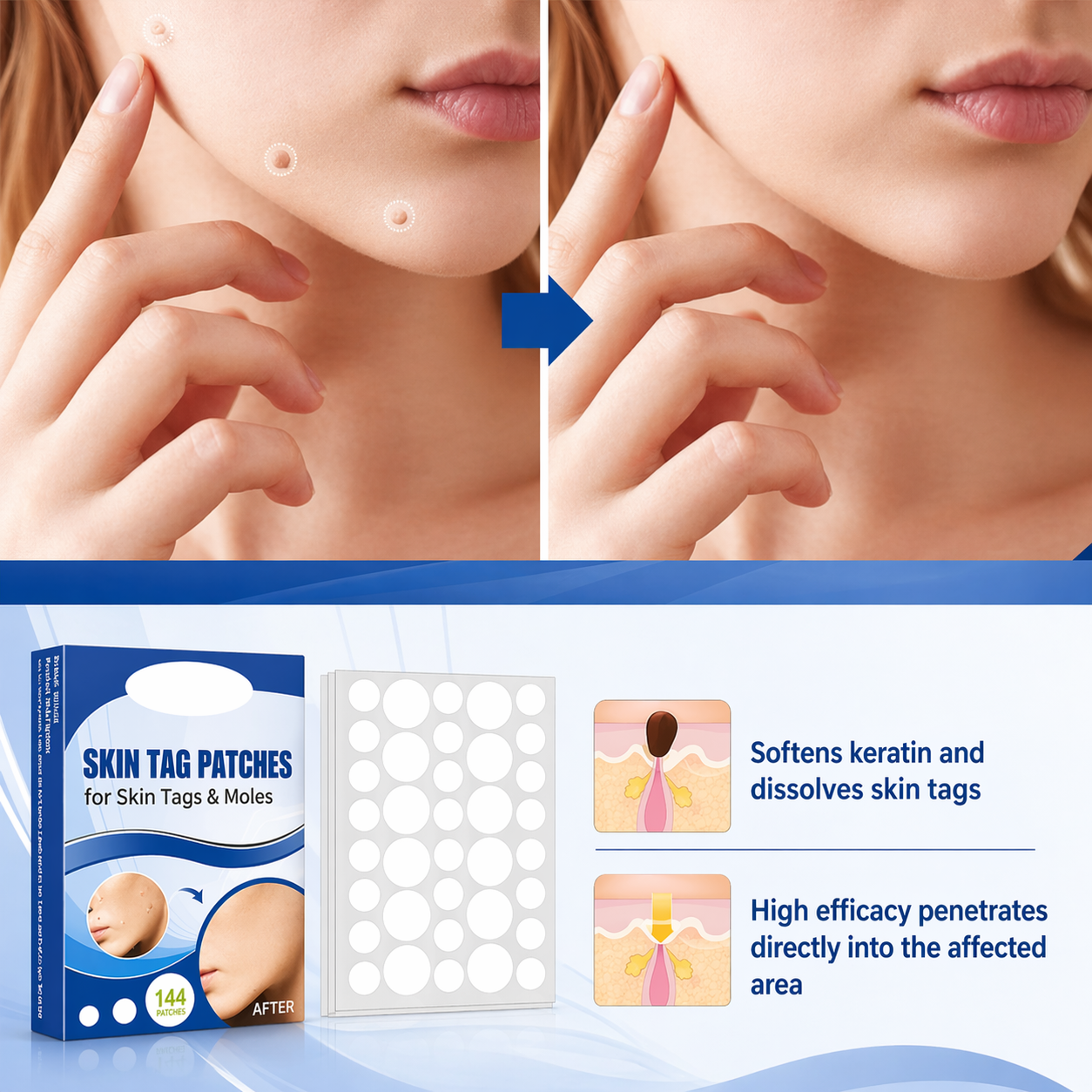 Cerotti per verruche | Applicazione discreta sulla pelle | Formula delicata per la cura a casa | TagAway