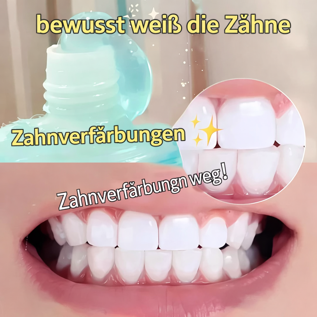 Zahnaufhellung Zahnpasta | Niacinamid Formel | Sanfte Fleckenreduktion | Brightelle