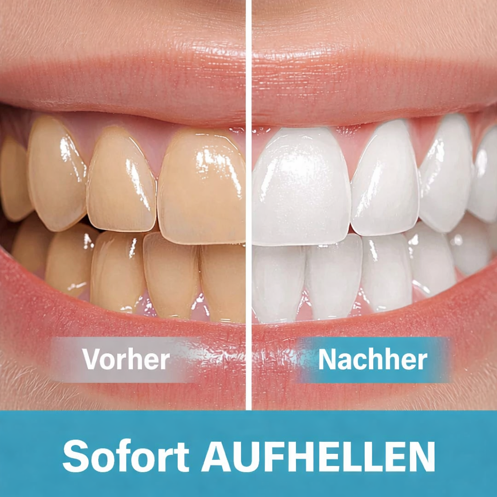 Zahnaufhellungs Zahnpasta | Sofortiger Aufhellungseffekt für Ihr Lächeln | Peroxidfreie Formel für empfindliche Zähne | BrightSmile