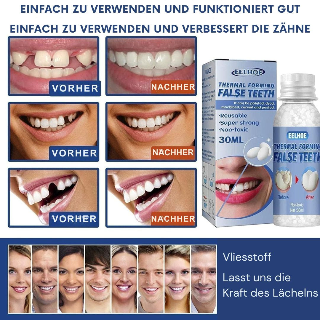 Zahnpflege | Zahnreparatur-Set | Sofortige Füllung von Zahnlücken | ToothPerfect