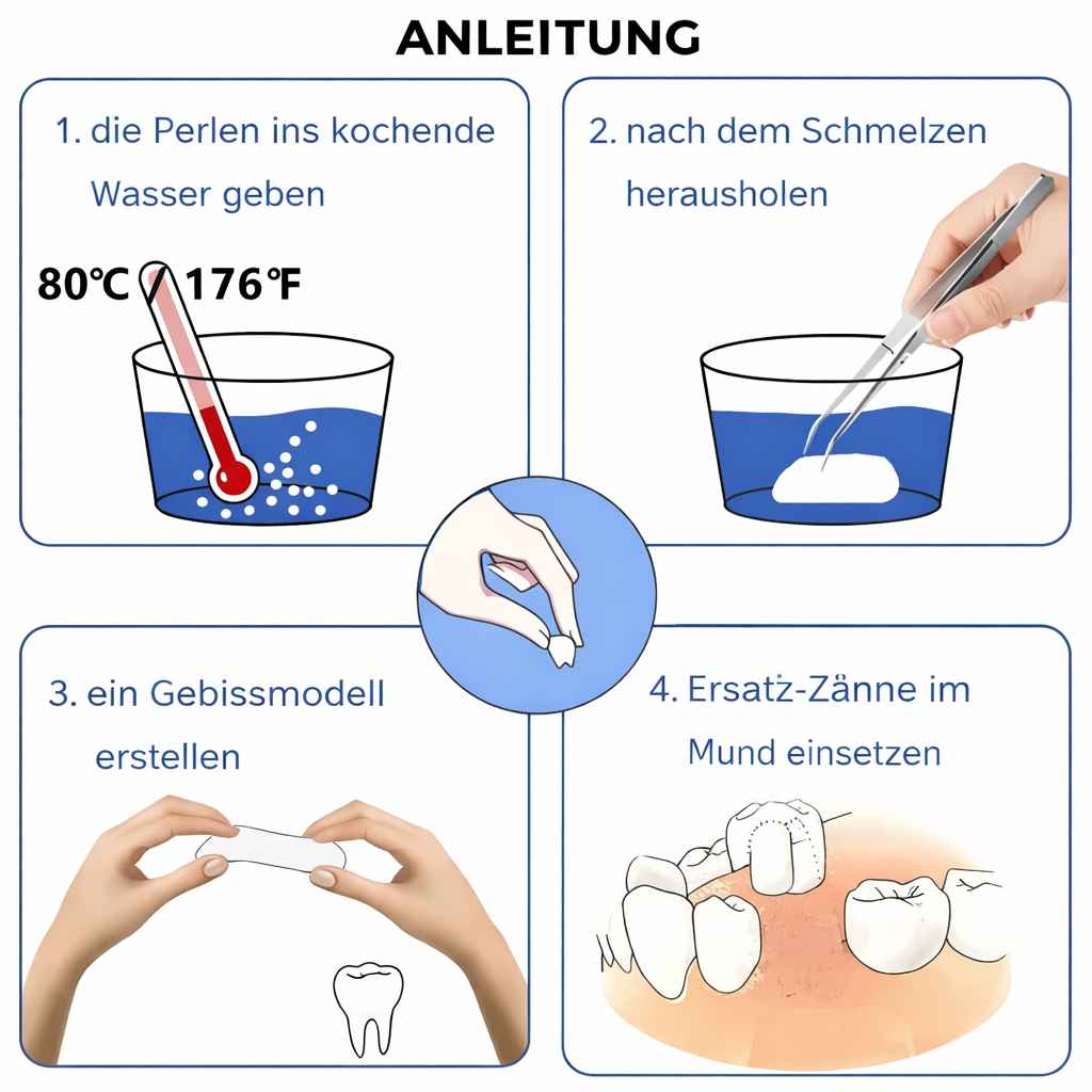 Zahnreparatur-Set | Formbarer provisorischer Zahnersatz | Revitooth