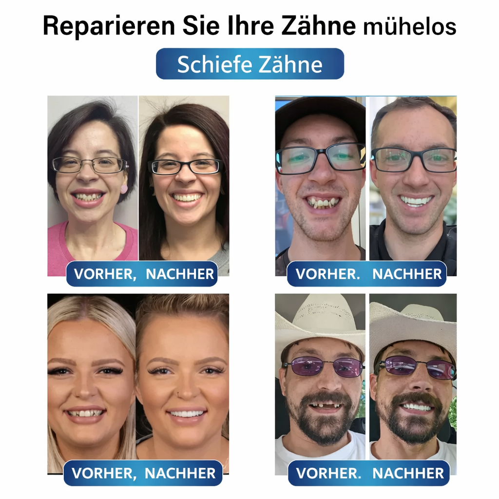 Zahnreparatur Set mit LED | Formbares Denture Gel | Sofortige Zahnreparatur | Futusly
