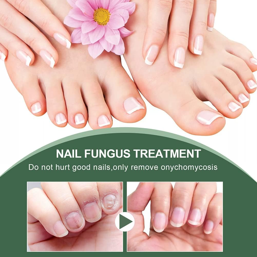 Nagel-Reparaturserum für Damen | Hypoallergene Tiefenformel | Stärkt, Glättet & Schützt Brüchige, Verfärbte Nägel 2