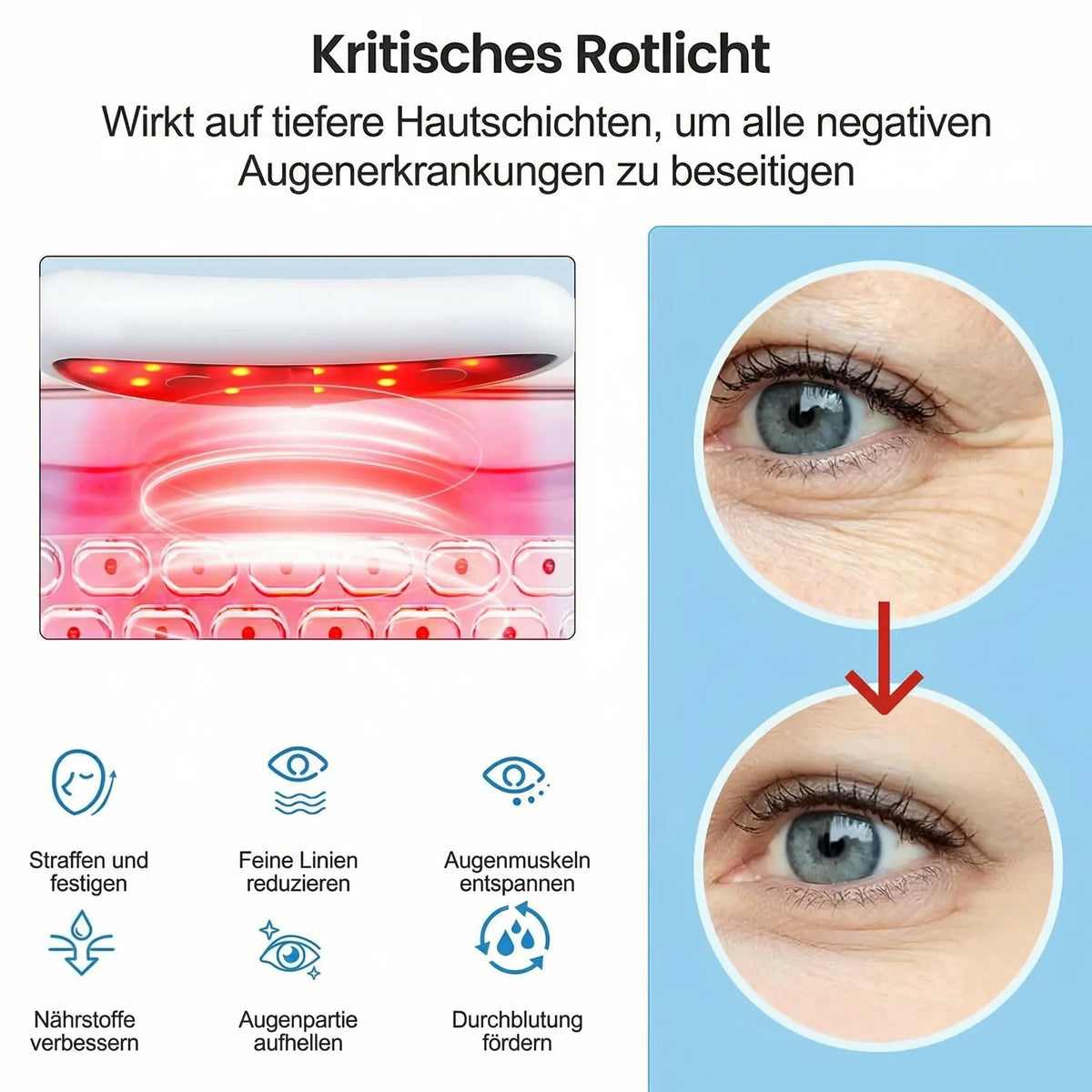 Rotlicht-Augenpflegegerät für Damen gegen Augenringe | Mikrostrom-Technologie | Sanfte tägliche Pflege für zuhause 3